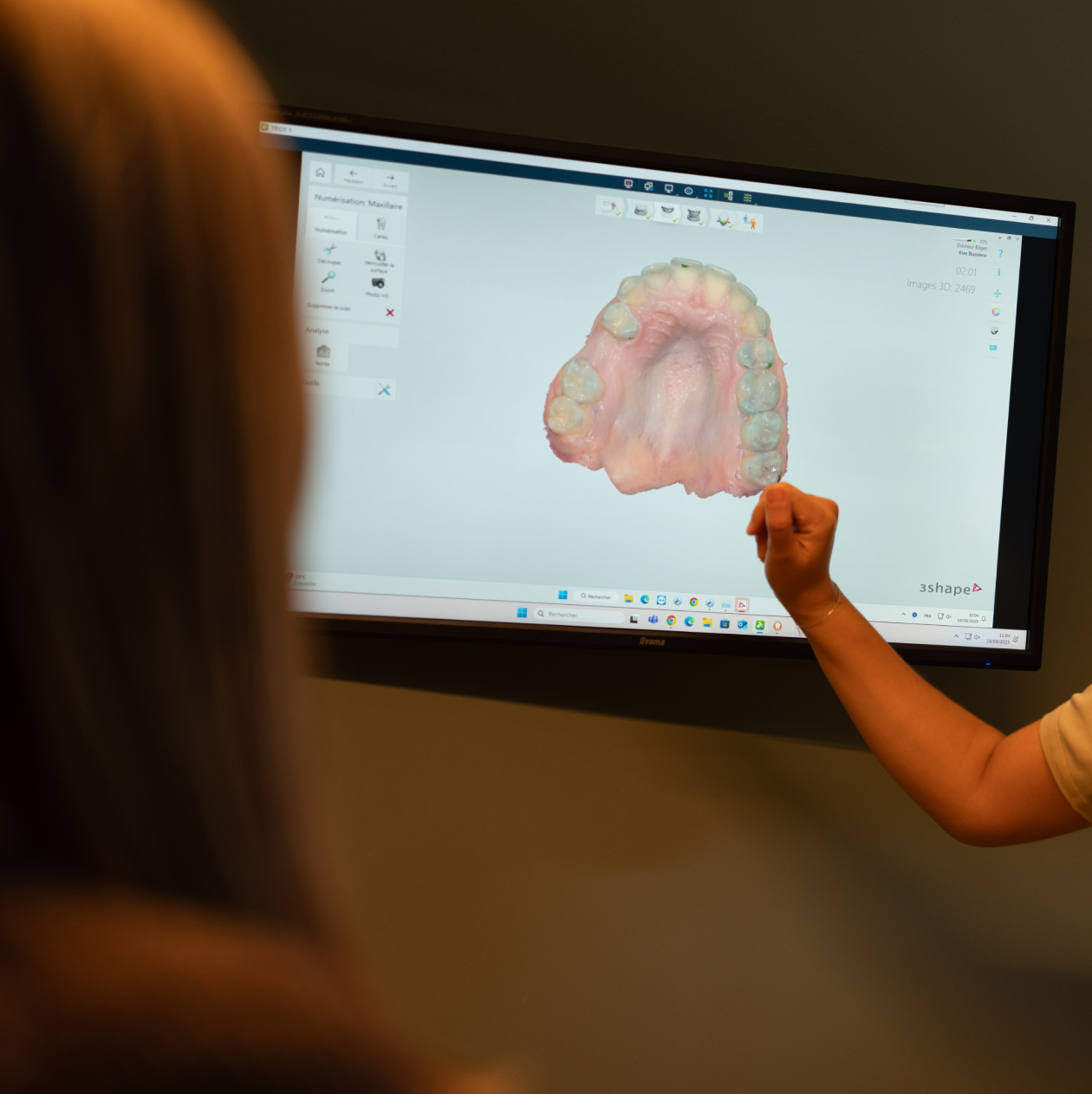 empreinte-optique-numerique-dentiste-pernes-les-fontaines Accueil Dentistes à Pernes-les-Fontaines | Pôle 158