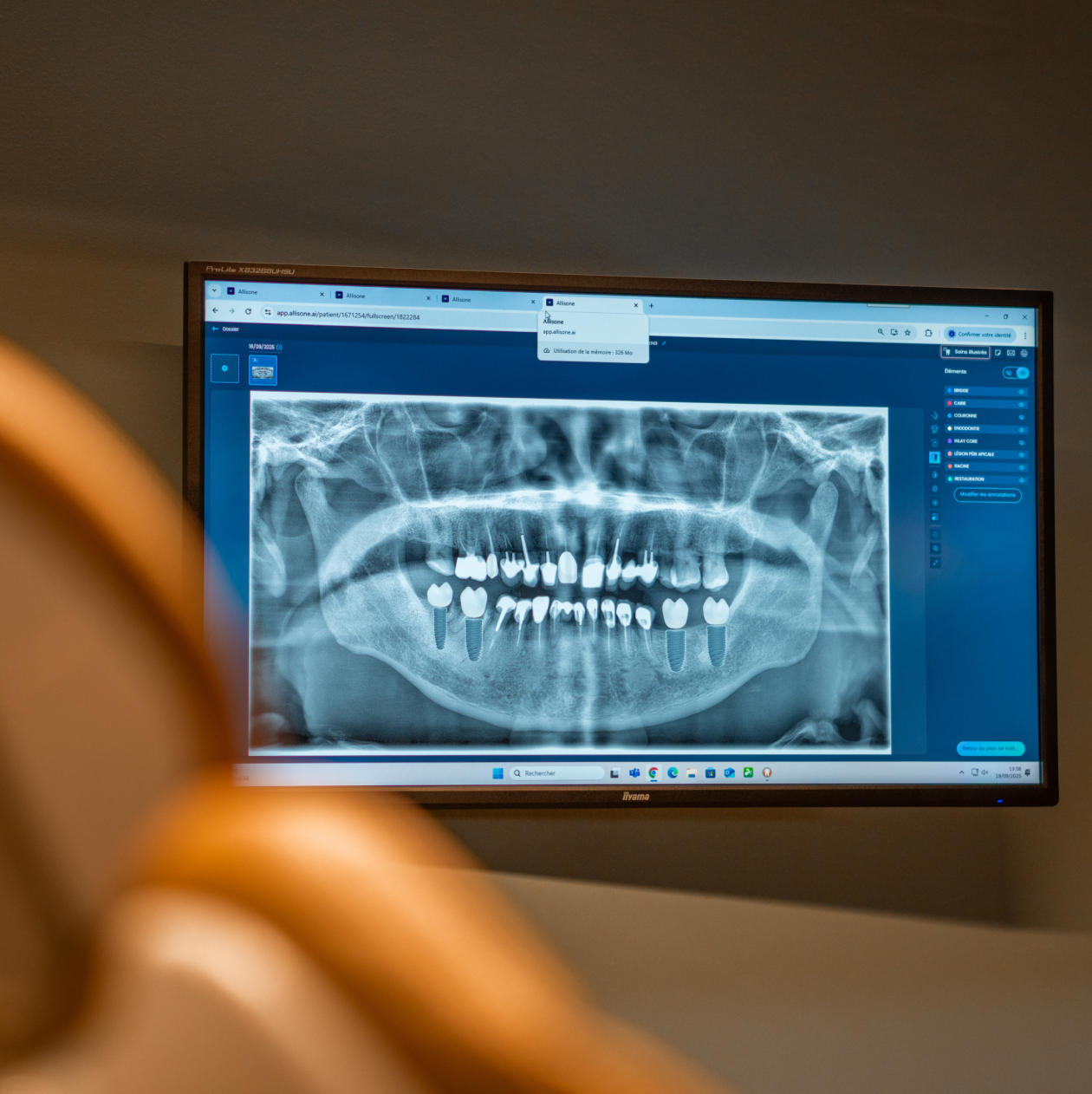 radiographie-dentiste-pernes-les-fontaines-1 Accueil Dentistes à Pernes-les-Fontaines | Pôle 158